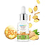 Mamaearth Skin Correct Face Serum with Niacinamide and Ginger Extract for Acne Marks and Scars 